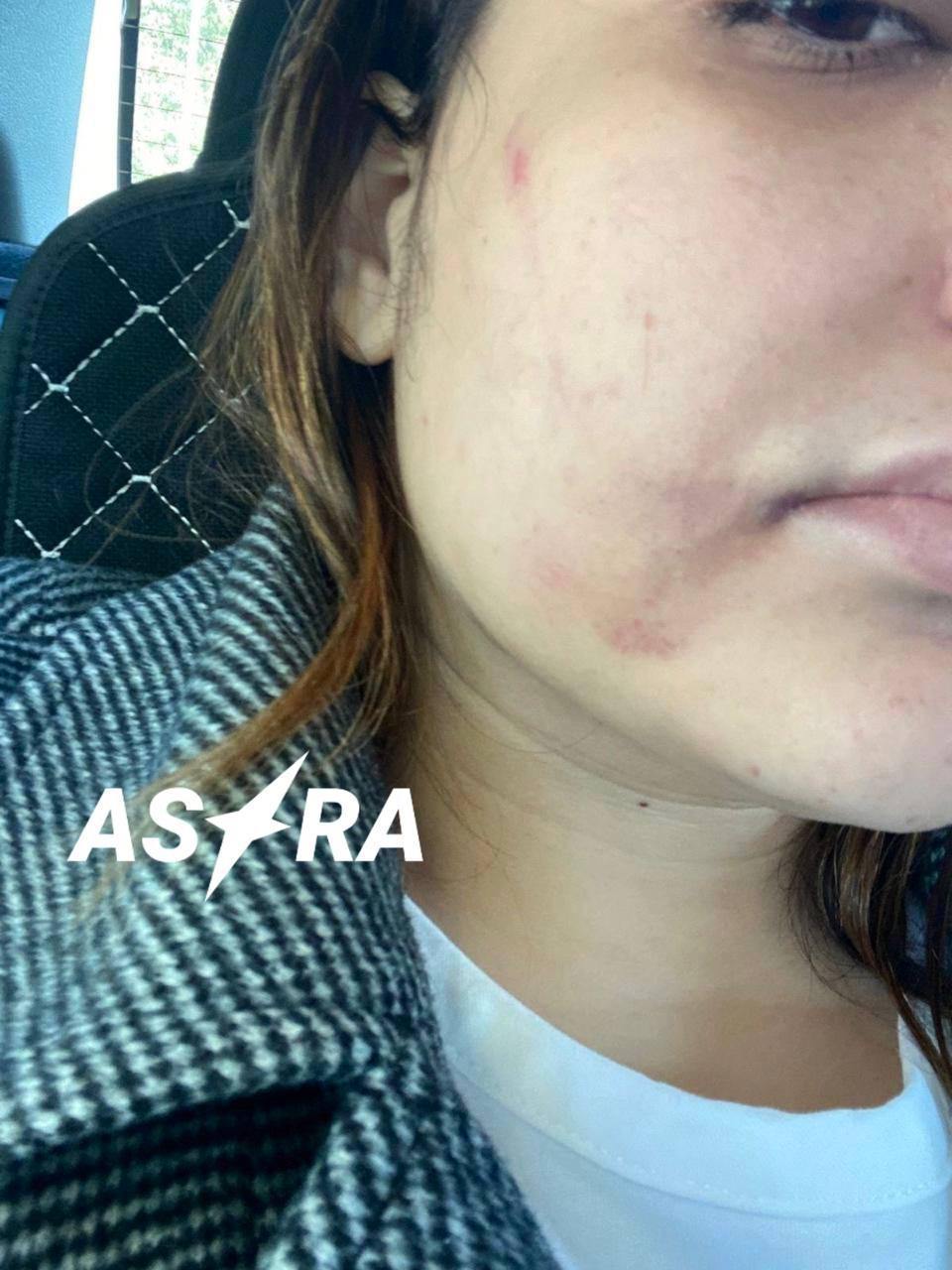 ASTRA sources face pressure after publishing an investigation about a torture basement in an abandoned mine in Donetsk